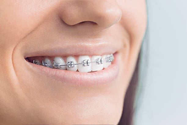 Best Veneers and Lumineers  in Bowling Green, MD